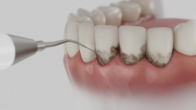 Trusted Tooth Extraction service in El Lago, TX - Dentist Open Now